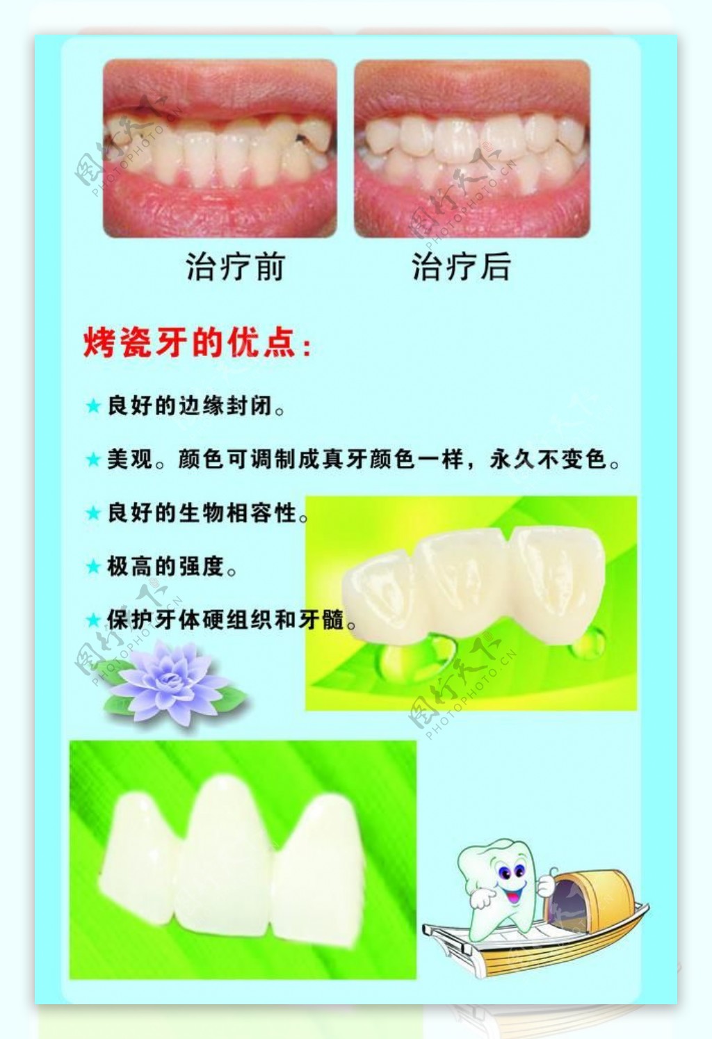 牙科KT板3图片