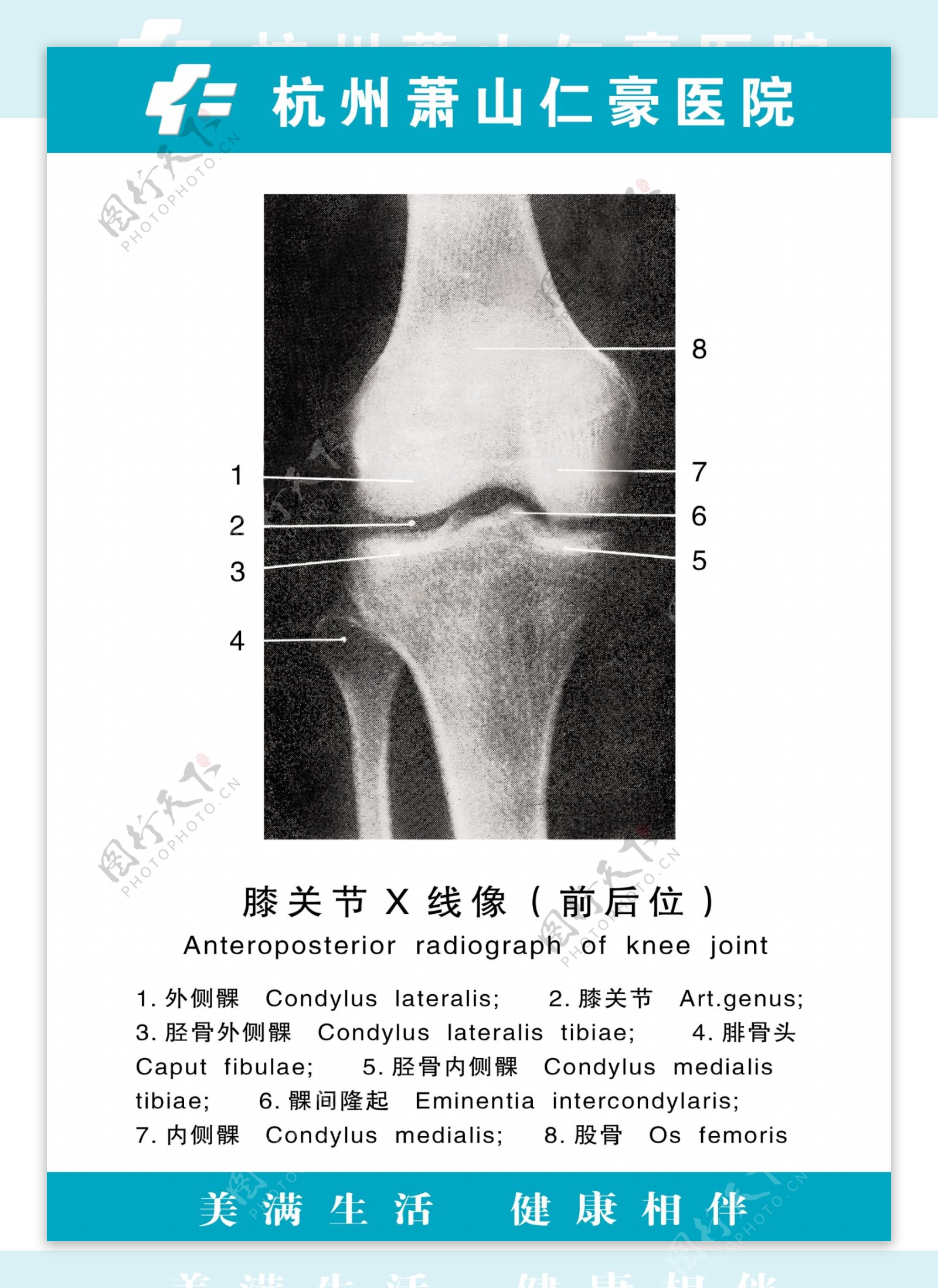 医疗人体科室挂图23膝关节X线像