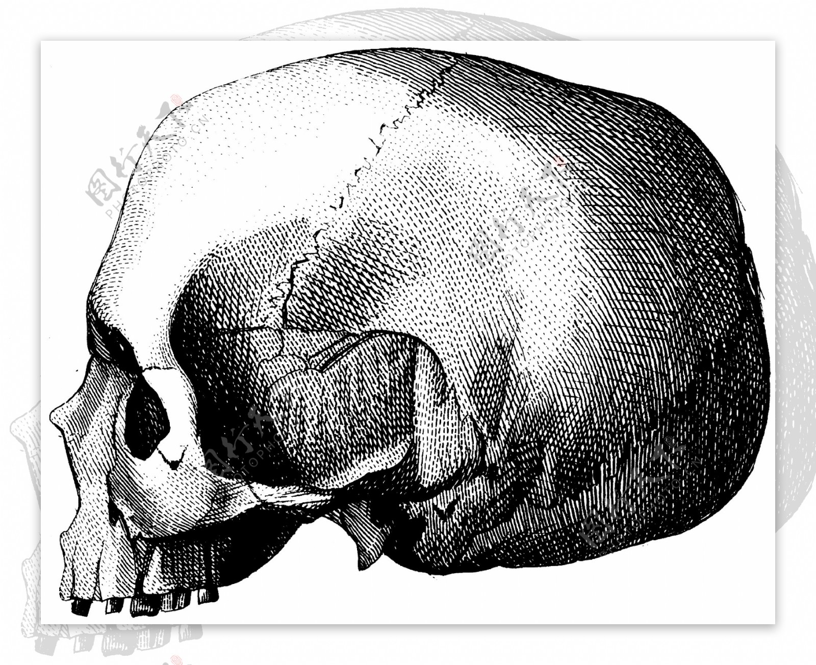 人体头盖骨侧面上部图片