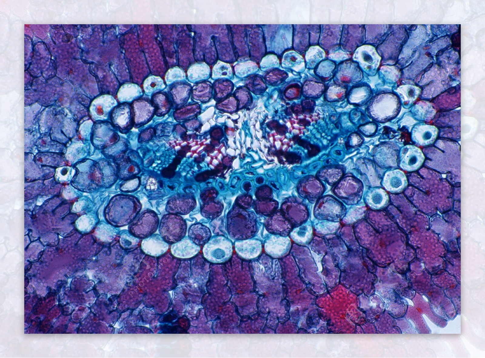 紫色斑点细胞结晶