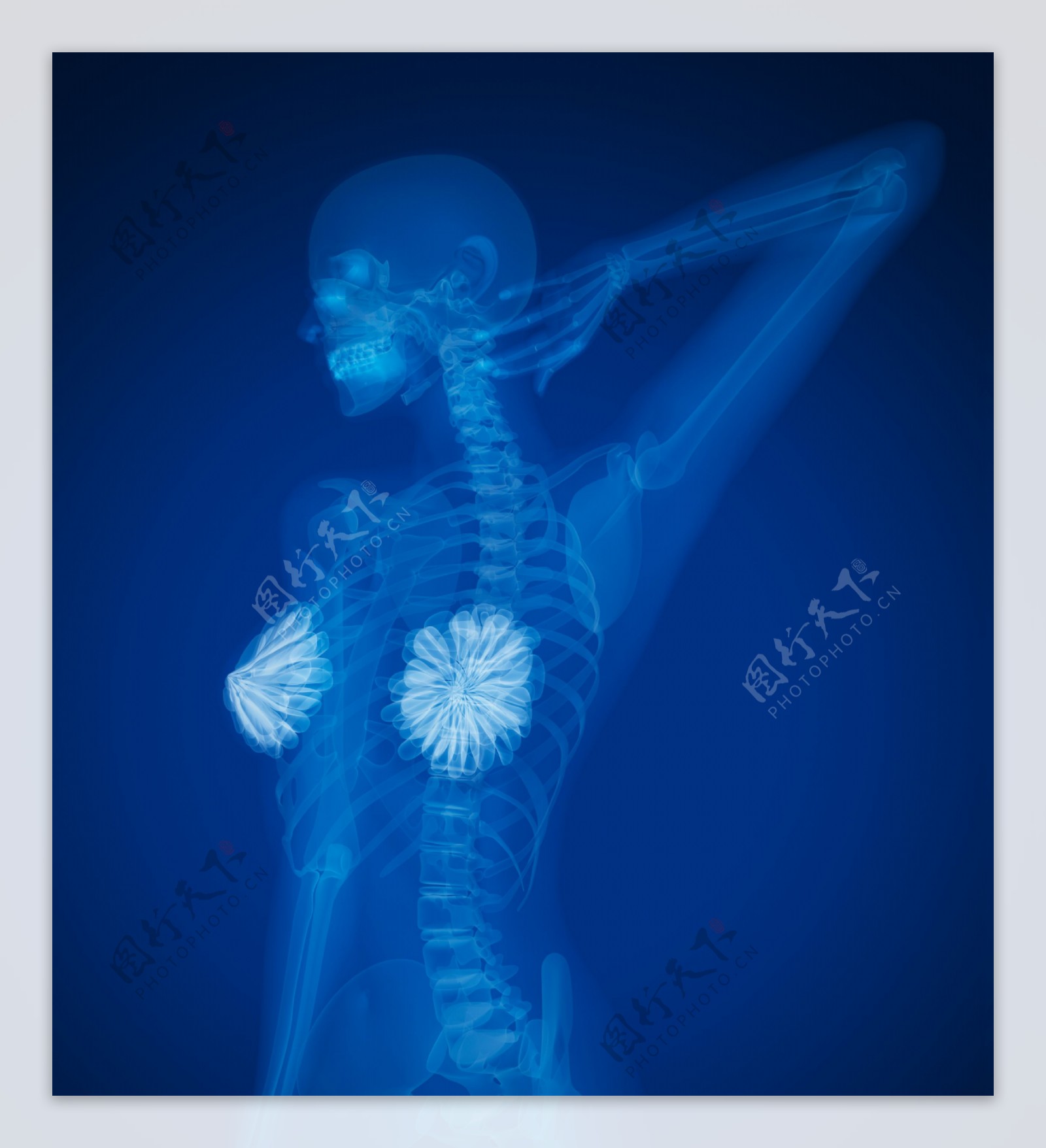 女人乳房X光图像图片