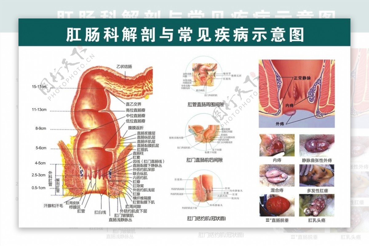 肛肠科挂图解剖图